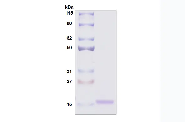 Recombinant Human Galectin 10, His Tag -25 ug